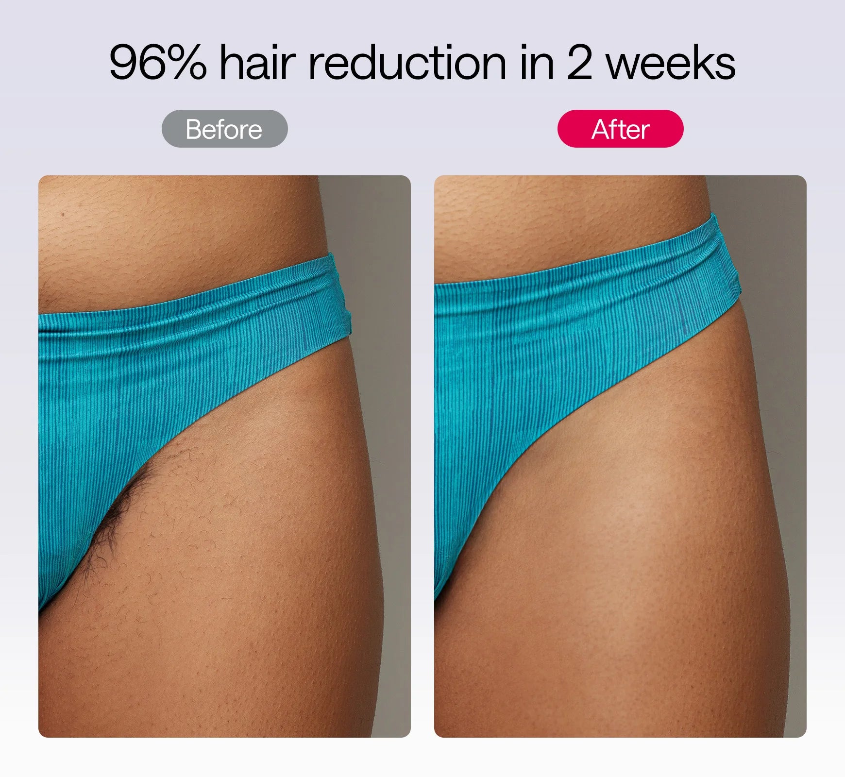 2025 Ulike Air 10 IPL Hair Removal Device